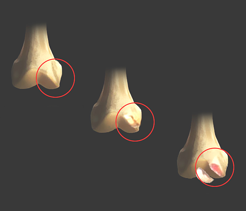 osteocondrite dissecante canina