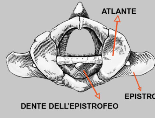 Lussazione vertebre cervicali cane C1 e C2